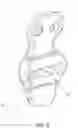 Fig. 09 - Three column spinal fixation implants and associated surgical methods