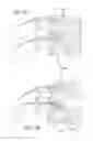 Fig. 09 - B-shaped interbody implant