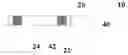 Fig. 01 - X-ray marker and endoprosthesis with X-ray marker