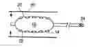 Fig. 01 - Methods for improving stent retention on a balloon catheter