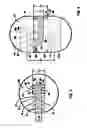Fig. 04 - Stent delivery catheter