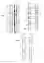 Fig. 02 - Coupleable support splint
