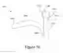 Fig. 04 - Nasal dilator devices