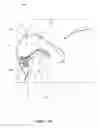 Fig. 06 - Nasal dilator devices