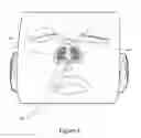 Fig. 10 - Nasal dilator devices