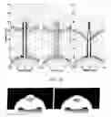Fig. 07 - METHOD AND APPARATUS UTILIZING MAGNETIC NANOPARTICLES FOR PERFORMING HYPERTHERMAL THERAPIES