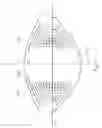 Fig. 25 - System and method for improving the accomodative amplitude and increasing the refractive power of the human lens with a laser