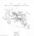 Fig. 02 - System and method for treatment of eustachian tube from middle ear approach