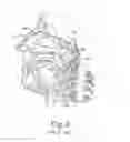 Fig. 03 - System and method for treatment of eustachian tube from middle ear approach