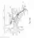 Fig. 14 - System and method for treatment of eustachian tube from middle ear approach
