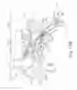 Fig. 15 - System and method for treatment of eustachian tube from middle ear approach
