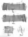 Fig. 02 - POSTOPERATIVE COMPRESSION BINDER