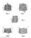 Fig. 03 - POSTOPERATIVE COMPRESSION BINDER