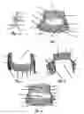 Fig. 04 - POSTOPERATIVE COMPRESSION BINDER