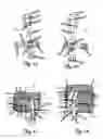 Fig. 05 - POSTOPERATIVE COMPRESSION BINDER