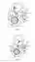 Fig. 05 - Mobility restraint device tensioner