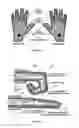 Fig. 04 - ACTUATOR DEVICE, METHOD AND SYSTEM FOR LIMB REHABILITATION
