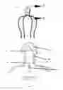 Fig. 03 - HEAD AND SCALP DEVICE AND USES THEREOF