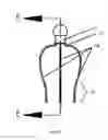 Fig. 05 - HEAD AND SCALP DEVICE AND USES THEREOF