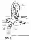 Fig. 02 - CPR QUALITY ASSESSMENT ACCOUNTING FOR PAUSE ASPECT