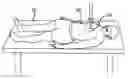 Fig. 01 - Lockable head up cardiopulmonary resuscitation support device