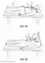 Fig. 02 - Lockable head up cardiopulmonary resuscitation support device
