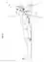 Fig. 13 - Lockable head up cardiopulmonary resuscitation support device