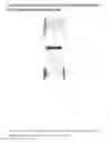 Fig. 02 - DUAL-CHAMBER PACK FOR EXTENDED RELEASE SUSPENSION COMPOSITIONS