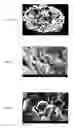 Fig. 11 - Stabilized HME composition with small drug particles