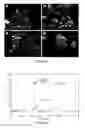 Fig. 13 - Disintegratable core/shell silica particles for encapsulating and releasing bioactive macromolecules