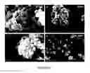 Fig. 14 - Disintegratable core/shell silica particles for encapsulating and releasing bioactive macromolecules