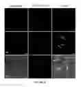 Fig. 15 - Disintegratable core/shell silica particles for encapsulating and releasing bioactive macromolecules