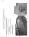 Fig. 09 - Compositions comprising electrohydrodynamically obtained fibres for administration of specific doses of an active substance to skin or mucosa