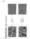 Fig. 11 - Compositions comprising electrohydrodynamically obtained fibres for administration of specific doses of an active substance to skin or mucosa