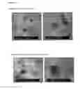 Fig. 15 - Compositions comprising electrohydrodynamically obtained fibres for administration of specific doses of an active substance to skin or mucosa