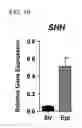 Fig. 11 - Methods for treating cancer by activation of BMP signaling