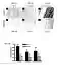 Fig. 03 - Nicotinic attenuation of CNS inflammation and autoimmunity