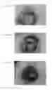 Fig. 07 - Anti-angiogenesis compound, intermediate and use thereof