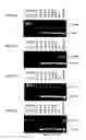 Fig. 12 - COMBINATION THERAPIES FOR HEMATOLOGIC MALIGNANCIES