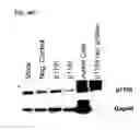 Fig. 50 - COMBINATION THERAPIES FOR HEMATOLOGIC MALIGNANCIES