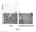 Fig. 03 - HETEROCYCLIC MODULATORS OF LIPID SYNTHESIS