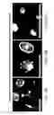 Fig. 12 - Nanoparticle formulations for delivering multiple therapeutic agents