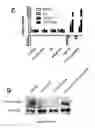 Fig. 20 - Composition comprising a combination of DNA methylation inhibitor and a vitamin D receptor agonist for the treatment of drug resistant cancer or for the prevention of tumor relapse