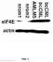Fig. 02 - Combination therapy using ribavirin as elF4E inhibitor