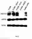 Fig. 09 - Combination therapy using ribavirin as elF4E inhibitor