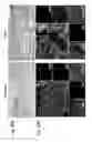 Fig. 30 - Method for non surgical repair of vertebral compression fractures