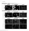 Fig. 02 - Bone formation promoter