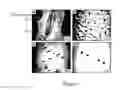 Fig. 02 - Composition and method for the treatment or prevention of spinal disorders
