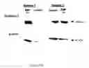 Fig. 22 - Composition and method for the treatment or prevention of spinal disorders