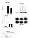 Fig. 04 - COMPOSITIONS AND METHODS FOR CHARACTERIZING, REGULATING, DIAGNOSING, AND TREATING CANCER